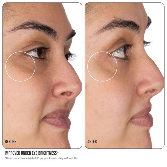 NIP + FAB Vit C Fix Eye Cream 10% - Picture 4 of 7